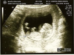 Innovatieve technieken om complicaties tijdens de zwangerschap te ontdekken