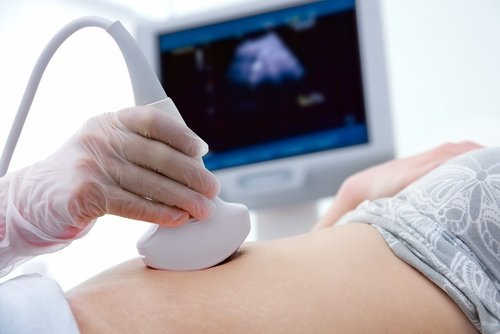 Echografie