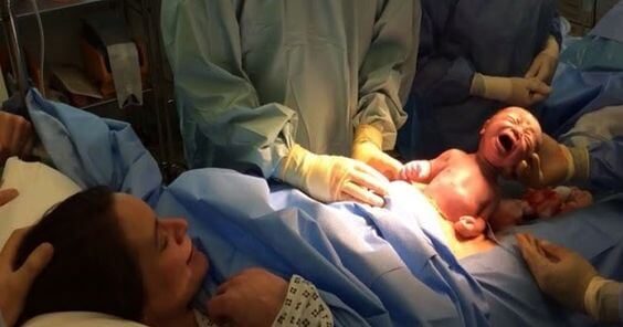 Een keizersnede is net zo complex als een natuurlijke geboorte