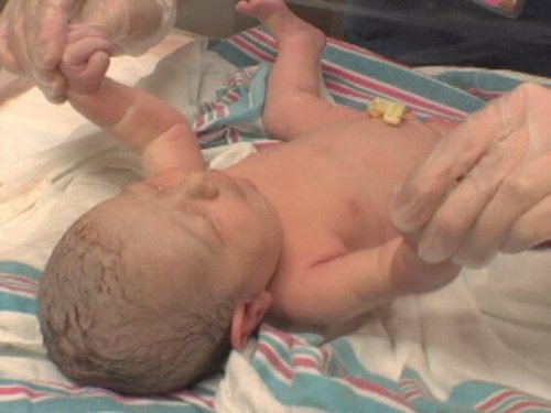 Apgar-test bij pasgeboren baby