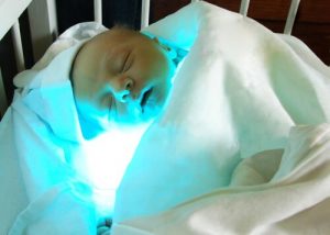 Wat is geelzucht en hoe wordt het behandeld?