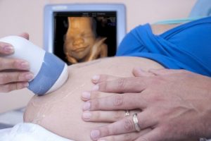De komst van nieuw leven: een moeder's liefde voor haar ongeboren kind