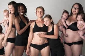 5 tips om te herstellen van rectus diastase