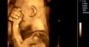 Wat je baby voelt als je van verdriet huilt tijdens de zwangerschap