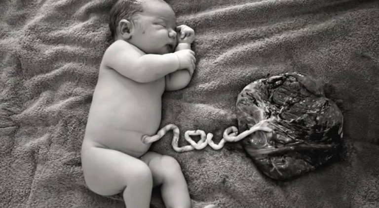 Het doneren van het bloed van de navelstreng is pijnloos