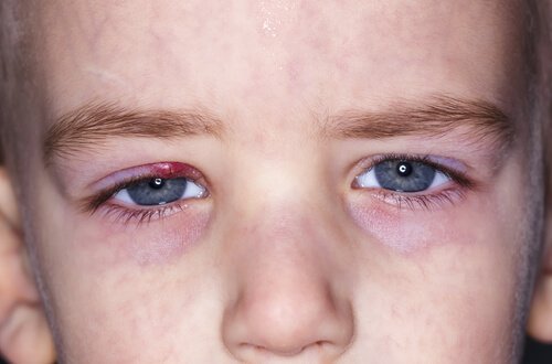 Oorzaken van strontjes bij kinderen