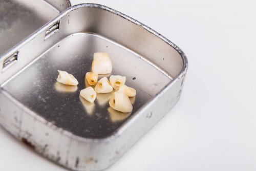 Stamcellen in melktanden Melktanden in een bewaarblikje