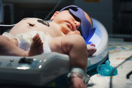 Leer meer over geelzucht bij pasgeborenen