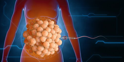 Overlevingsstrijd van sperma