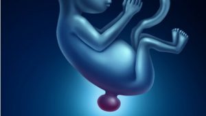 Baby's geboren met spina bifida