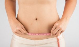 Het verzorgen van het litteken van een keizersnede