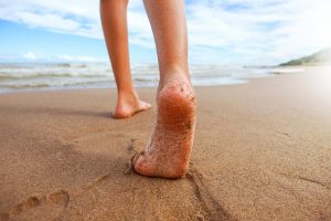 Het corrigeren van O-benen bij kinderen