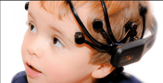 Eelectroencephalografie voor milde epileptische aanvallen