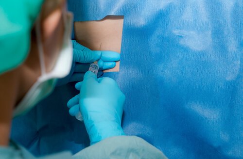 Spinale anesthesie: wat is de rol ervan tijdens de bevalling