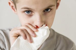 Kinderen met een bloedneus: oorzaken en behandeling