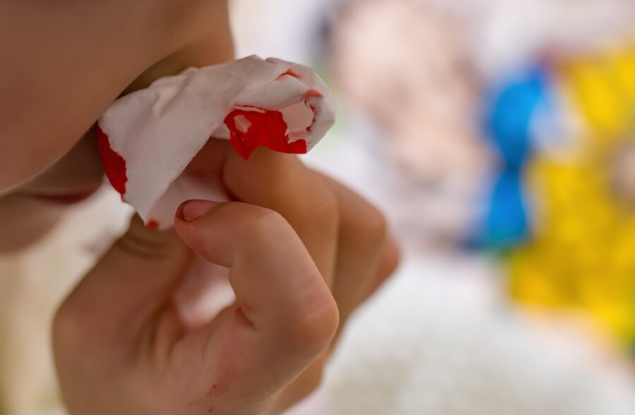 Soorten bloedneus bij kinderen