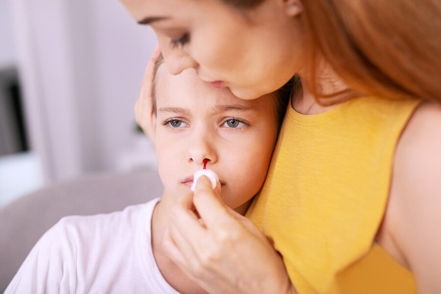Een bloedneus bij kinderen behandelen