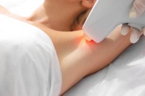 Mag je laser ontharen tijdens de zwangerschap?