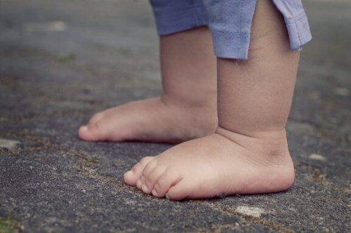Achondroplasie bij kinderen: oorzaken en kenmerken