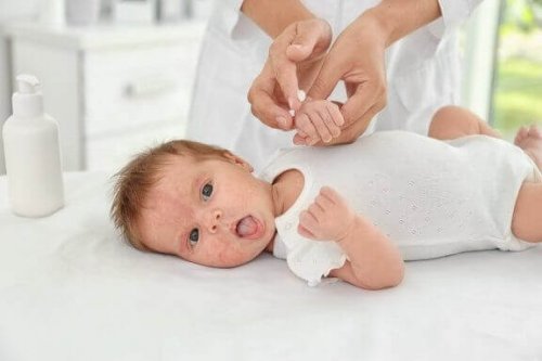 Baby met eczeem op het gezicht