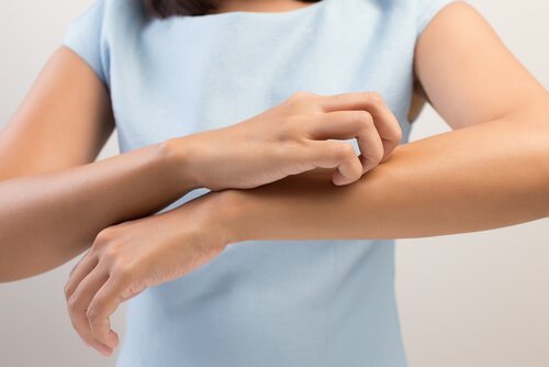Vrouw krabt aan haar arm
