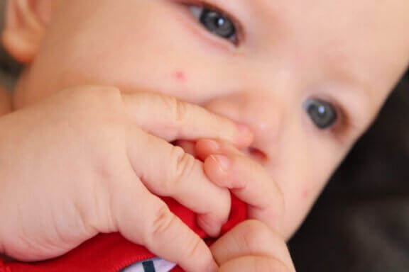 Kind heeft milia