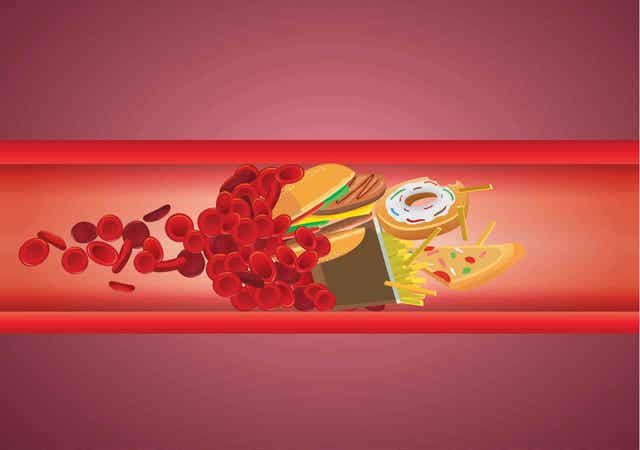 Hoog cholesterol bij kinderen