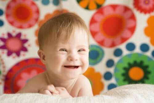 Is borstvoeding geven problematisch bij Downsyndroom