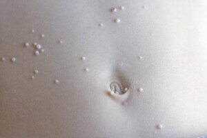 Molluscum contagiosum bij je kind: wat te doen?