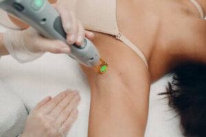 Laserontharing voor tieners: wat je moet weten