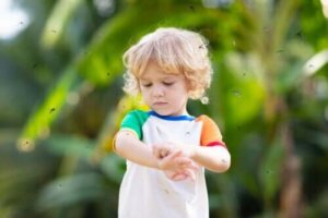 Wat is prurigo simplex bij kinderen?