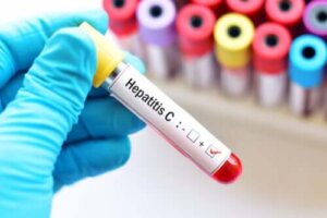 Hepatitis C tijdens de zwangerschap
