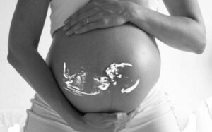 Zwangerschap na een sterilisatie, is het mogelijk?