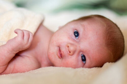 Huiduitslag bij baby's: wat je moet weten