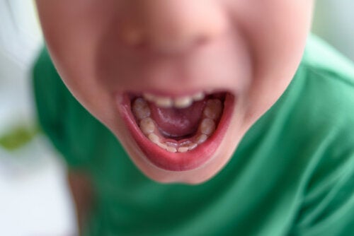 Een dubbele rij tanden bij kinderen: wat te doen?
