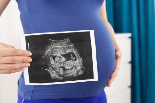 De soorten echografieën tijdens de zwangerschap