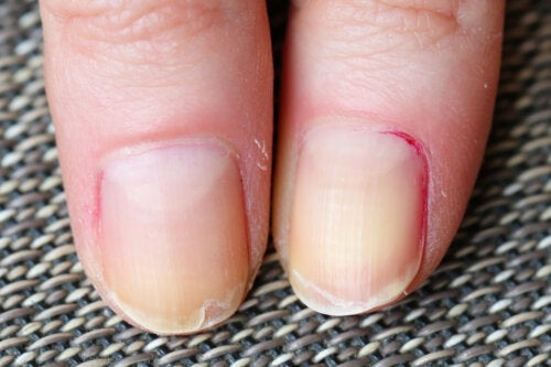 Huismiddeltjes om je nagels te versterken na de bevalling