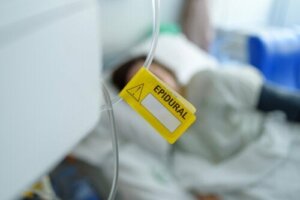 Soorten anesthesie bij de bevalling