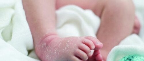 10 Meest voorkomende huidaandoeningen bij baby’s