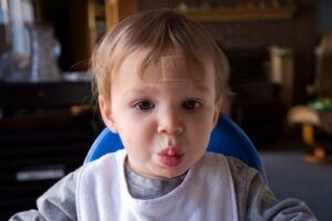 Tips voor het camoufleren van littekens bij kinderen