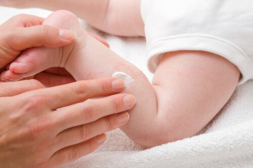 Natuurlijke remedies voor droge huid bij baby's