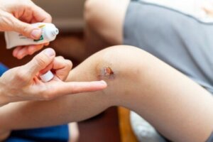 Hoe behandel je geïnfecteerde wonden bij kinderen?