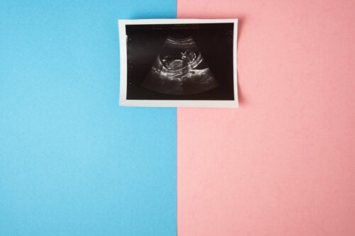 Het geslacht van je baby weten bij de eerste echografie: Is het mogelijk?