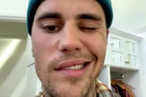 Het syndroom van Ramsay Hunt, de aandoening die Justin Bieber heeft
