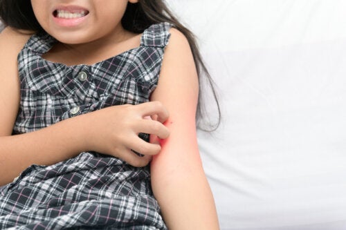 Dermatillomanie bij kinderen: wat is het?