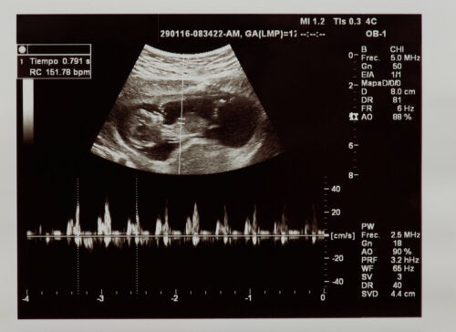 Hoe is de hartslag van de foetus in de baarmoeder?