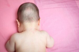 Waarom heeft mijn baby kale plekken?