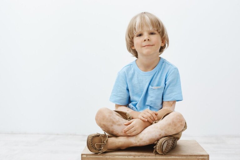 4 soorten voedingsmiddelen om vitiligo bij kinderen te verbeteren