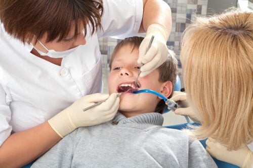 Bacteriële tandplak en tandsteen bij kinderen