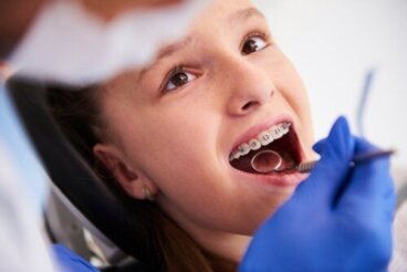 De fasen van een orthodontische behandeling bij kinderen